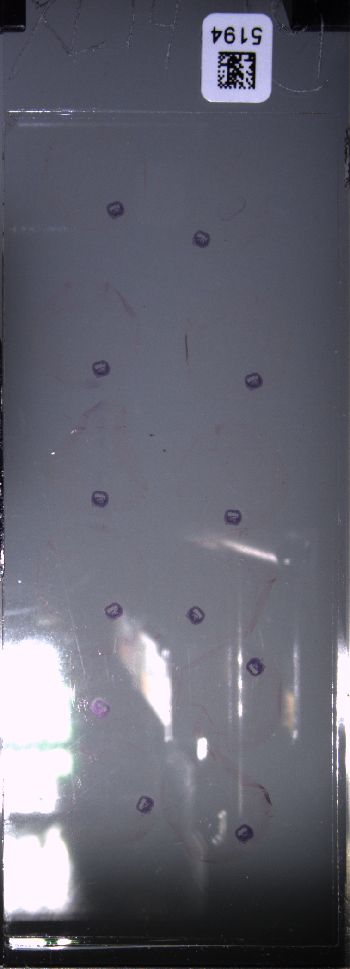 Media type: image; Special Collections 4011   shows specimen_part histological serial section;